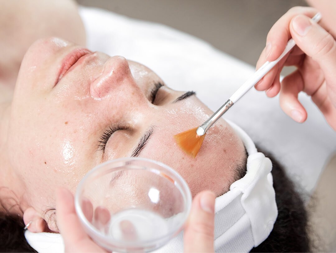 Glycolic Skin Peel